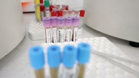 Над 7.66 милиона души по света са заразени с коронавирус