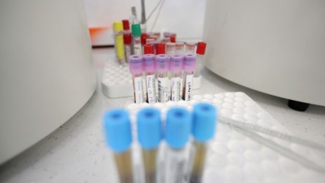 Украйна с рекорд на заразени с вируса за денонощие 