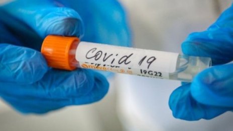 Бебе на 9 месеца с коронавирус в Пловдив