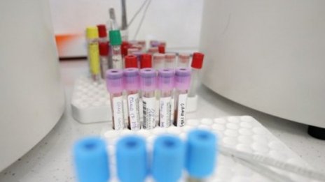 Щом умират млади хора от коронавирус, нещо не оценяваме!