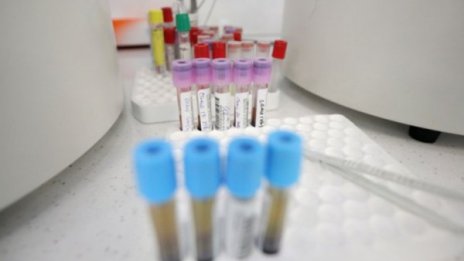 Д-р Кацаров: Риск за България има при 2500 - 3000 заразени на ден