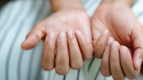 8 здравословни проблема, за които подсказват ноктите 