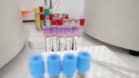Украйна с нов рекорд на новозаразени с коронавирус