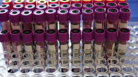 Лекар от Хасково е сред новозаразените с COVID-19