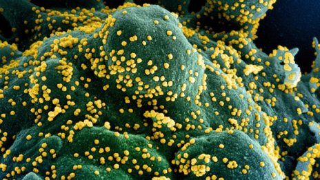 Коронавирусът може да оцелее до 28 дни - много по-дълго от грипа