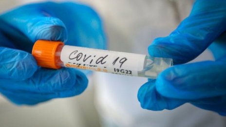 91-годишен с придружаващи заболявания пребори  COVID-19