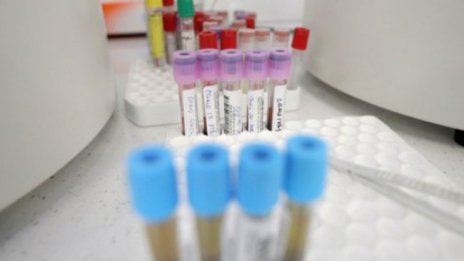 107 са новите случаи на COVID-19 в Пловдивско