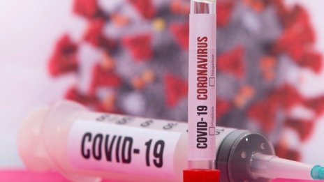 42-годишен без заболявания е сред жертвите на COVID-19