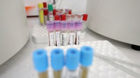 Лекар и медсестра са сред новозаразените с COVID-19 в Хасковско