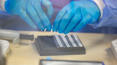 PCR не трябва да се прави веднага след контакт с болен