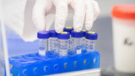 Дълги опашки пред лабораториите за PCR-тест