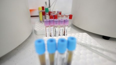 Сред жертвите на вируса у нас отново без други заболявания