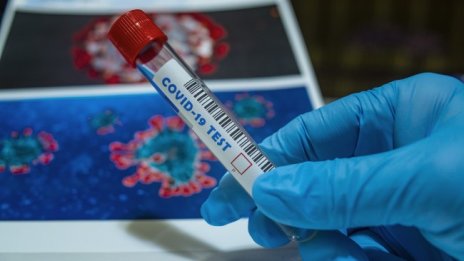 Тестват българската ваксина срещу COVID-19 през април-май 