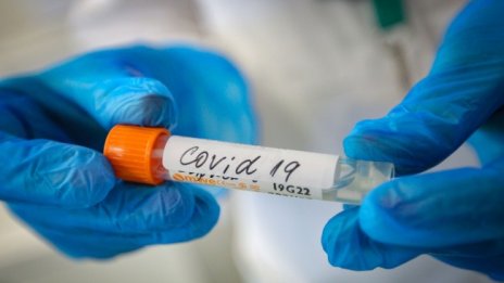 Жени на 21 и 33 години без заболявания сред жертвите на вируса у нас