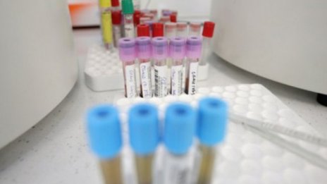 Петима учители сред новите случаи на COVID-19 в Старозагорско