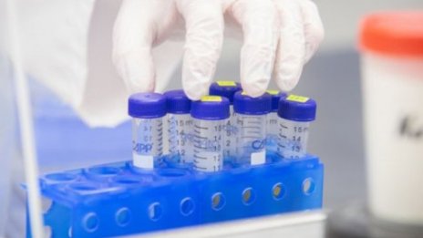 Сред жертвите на коронавируса - мъже на около 40 г. без заболявания