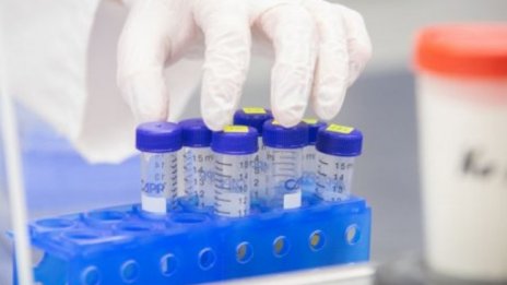 Висок брой на новозаразени с коронавирус, починали са 162-ма души