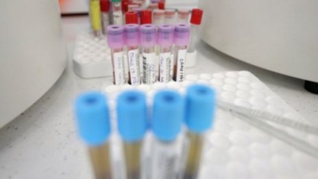 Сред жертвите на коронавируса и момиче на 24 години