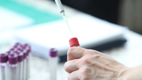 Плащаш си PCR в лаборатория, данните неотчетени и болничен няма