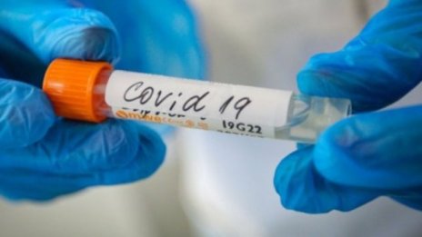  Откриха какво предизвиква тежката симптоматика на COVID-19