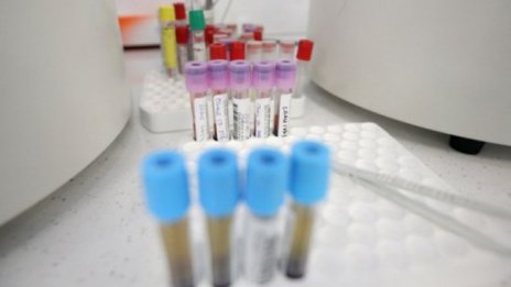 21% от тестваните у нас са с коронавирус - 166 души, излекувани за денонощието -1732-ма