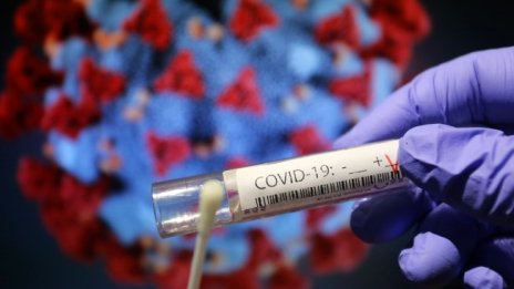 1615 новозаразени през денонощието, 99 души са починали