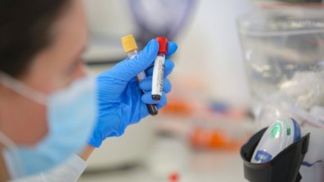 Едва 171 нови случая на коронавирус, 6,42% са позитивните тестове 