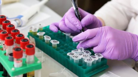 867 са новите случаи на коронавирус, починалите са 56