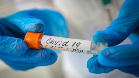 Двама мъже на 48 г. най-младите починали от вируса