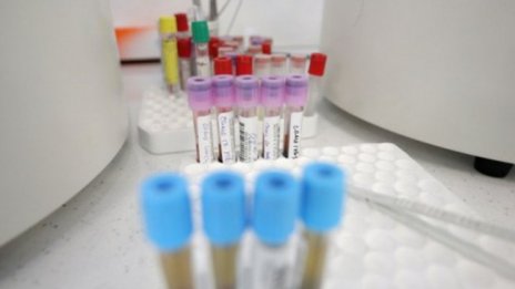 За денонощието: 4,5% положителни за коронавирус, 627 излекувани, 24 починали
