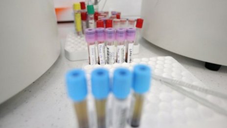 Лек спад: 719 са новите случаи на коронавирус, 7,3% от направените тестове