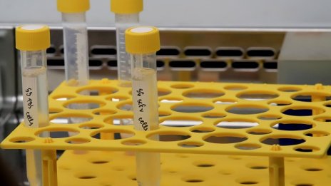 1463 са новозаразените с COVID, 11% от пробите са положителни