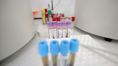 27-годишен със сърдечно заболяване сред жертвите на вируса