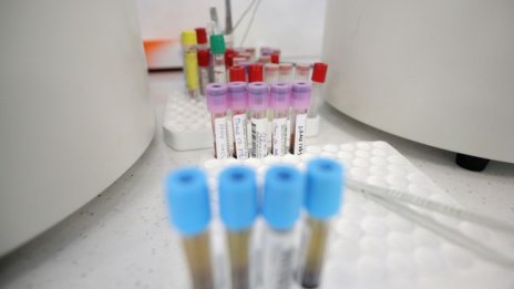 Жени на 36 и 42 г. без болести сред починалите от вируса