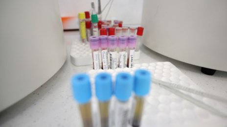 32-годишна с диабет сред починалите от вируса 