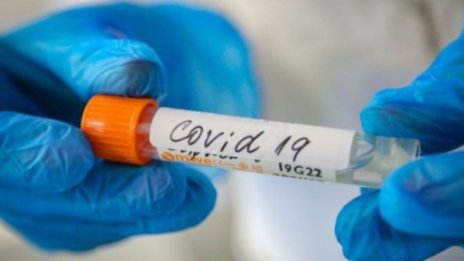 Проф. Александрова: COVID-19 ще продължи да произвежда нови мутации