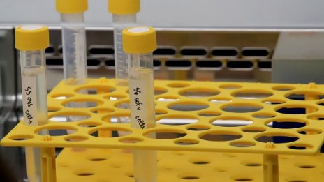 4497 са новите случаи на COVID-19, 203 души са починали 