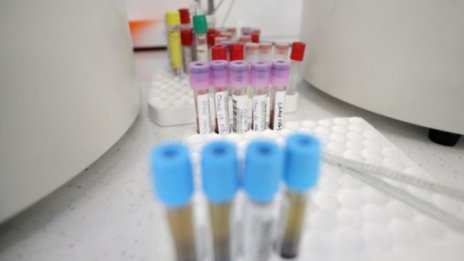 Висок е броят на хоспитализираните от коронавирус в МБАЛ-Шумен 