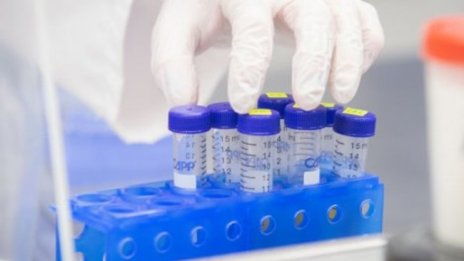 Учени откриха мутацията в COVID-19, повишаваща неговата устойчивост
