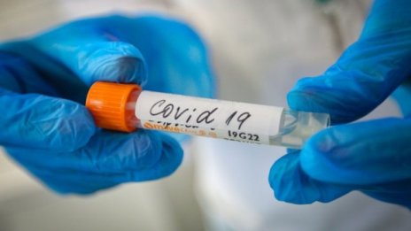 COVID-19 - сърдечно-съдово, а не респираторно заболяване?