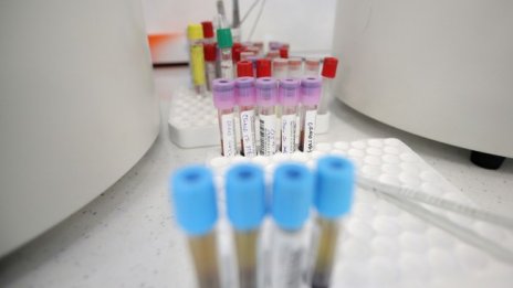 49-годишна жена без болести сред починалите от вируса 