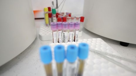 Четиримата починали от вируса днес имат и други заболявания