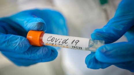 Повечето починали за денонощието са със сърдечни болести