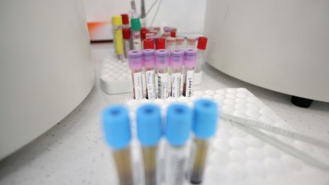 28-годишен е сред жертвите на вируса за денонощието
