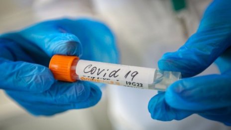 Държавата да плаща възстановяване след COVID-19 в СПА центрове?
