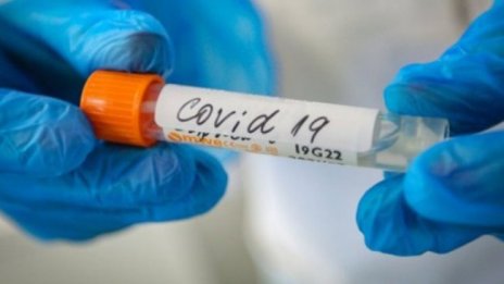 Учени откриха "свръхчовешки" имунитет към COVID-19 при някои хора