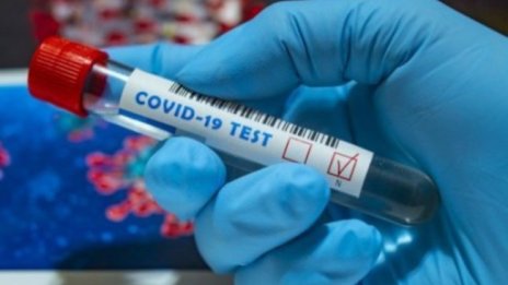 Пандемията може и да приключи, но ефектът на дългия Covid ще остане