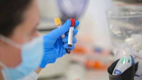 34-годишен мъж без болести е сред починалите с COVID-19 