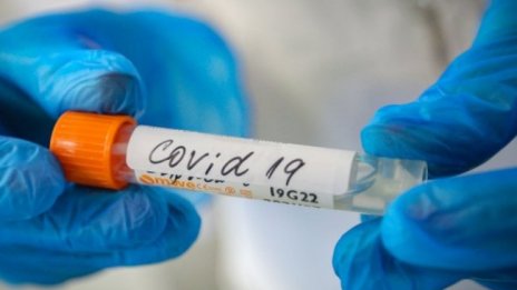 Армията в Словения се включва в лечението на COVID болни