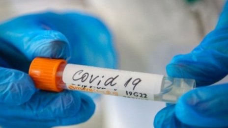 Кога човек е възстановен от COVID-19?